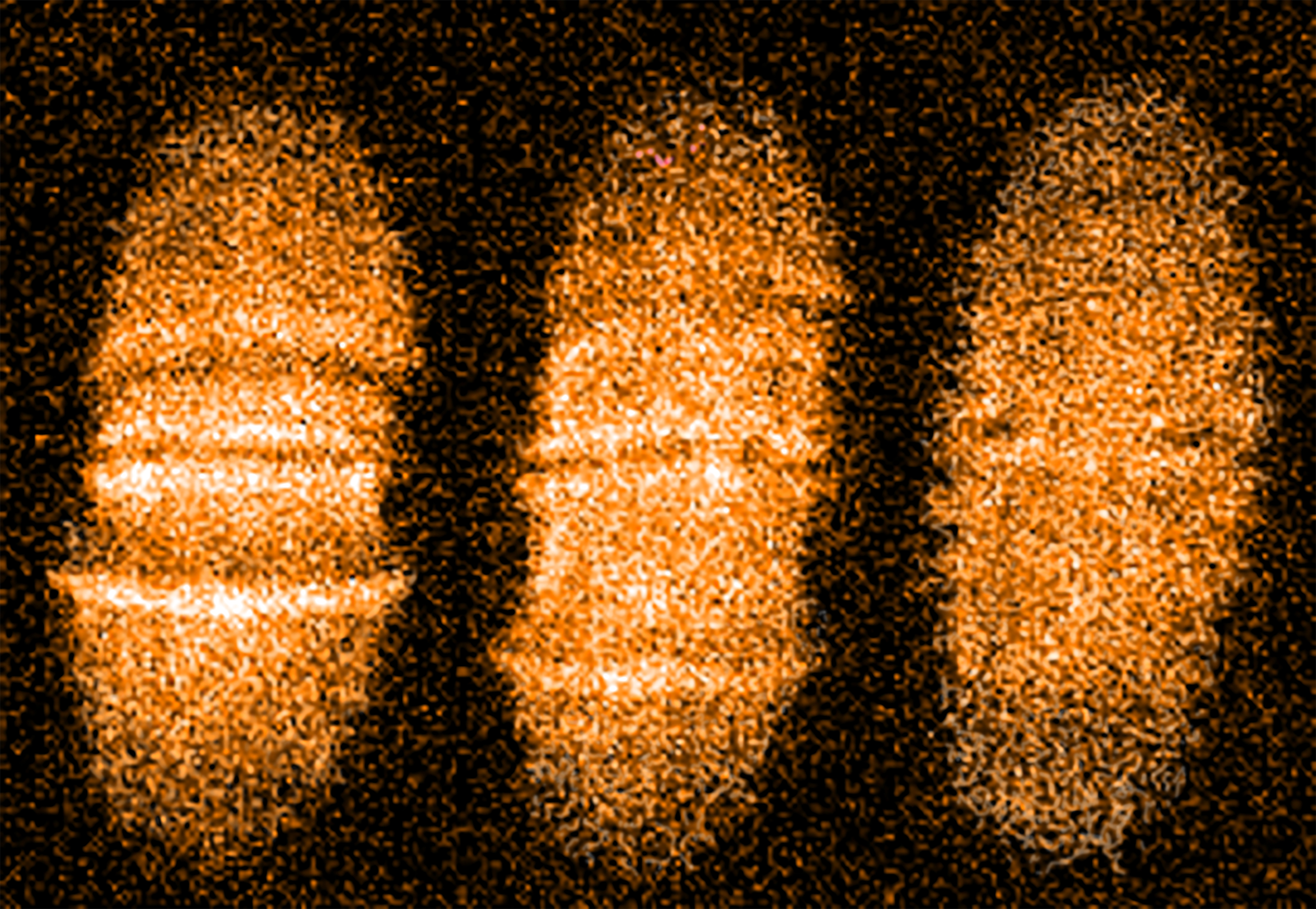 From solitons to vortex rings